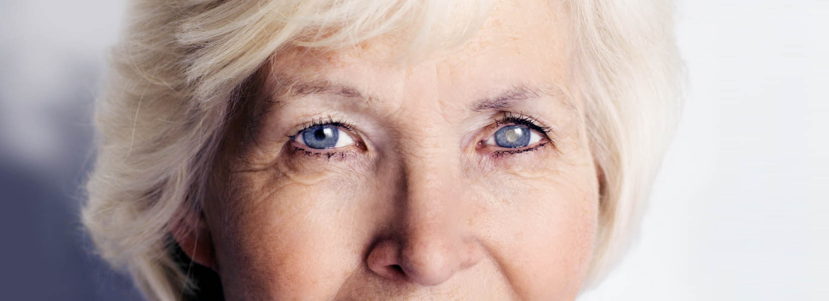 Cataract Surgery in Delmar